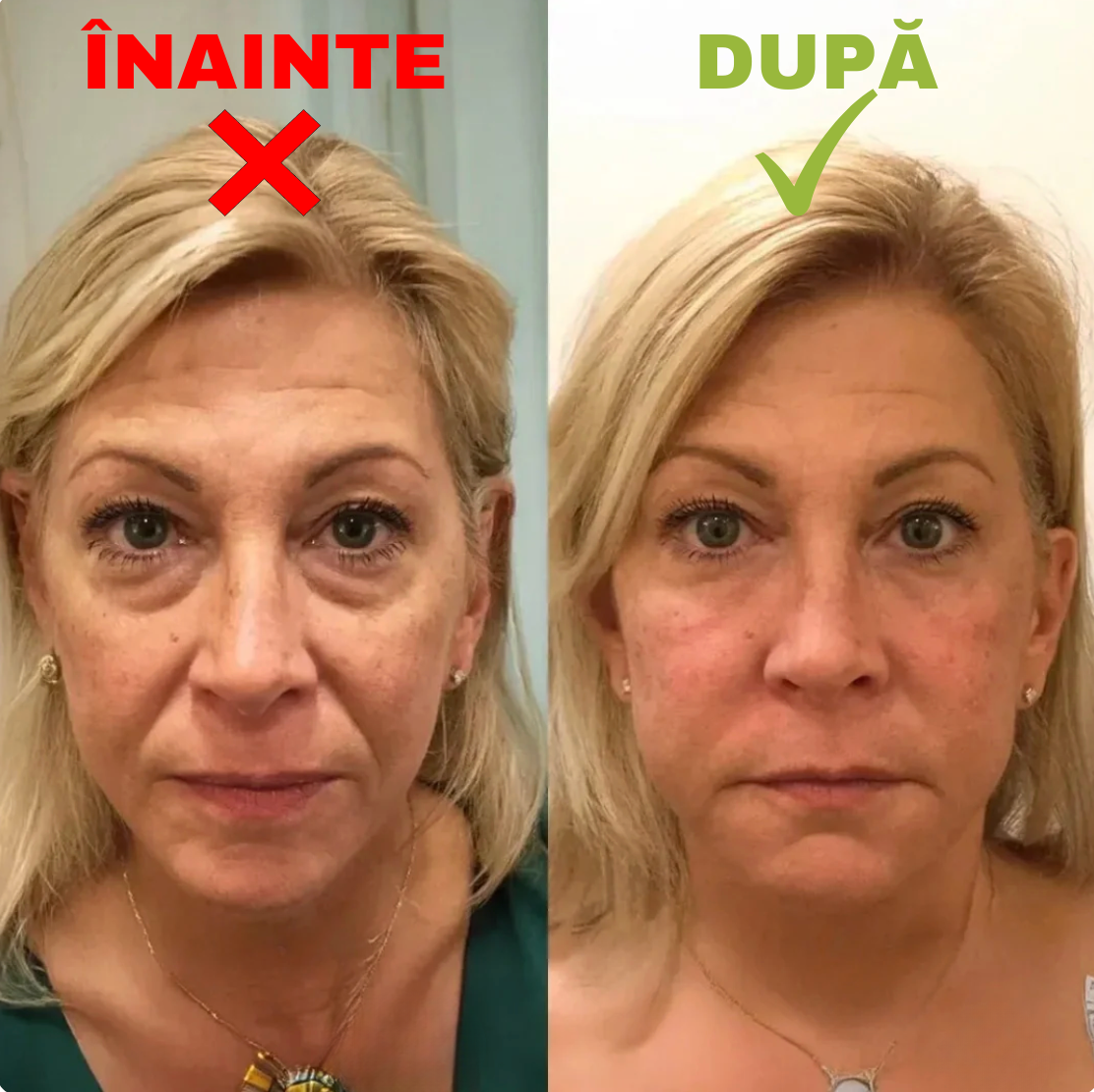 STERGATOR DE CEARCANE SI RIDURI